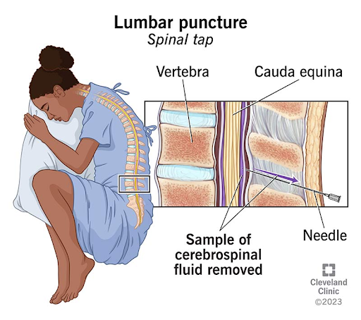 Image from Cleveland Clinic